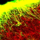 Trophic Support of Axons