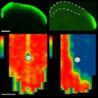 Axonal Transport in Central Brain