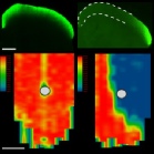 Axonal Transport in Central Brain